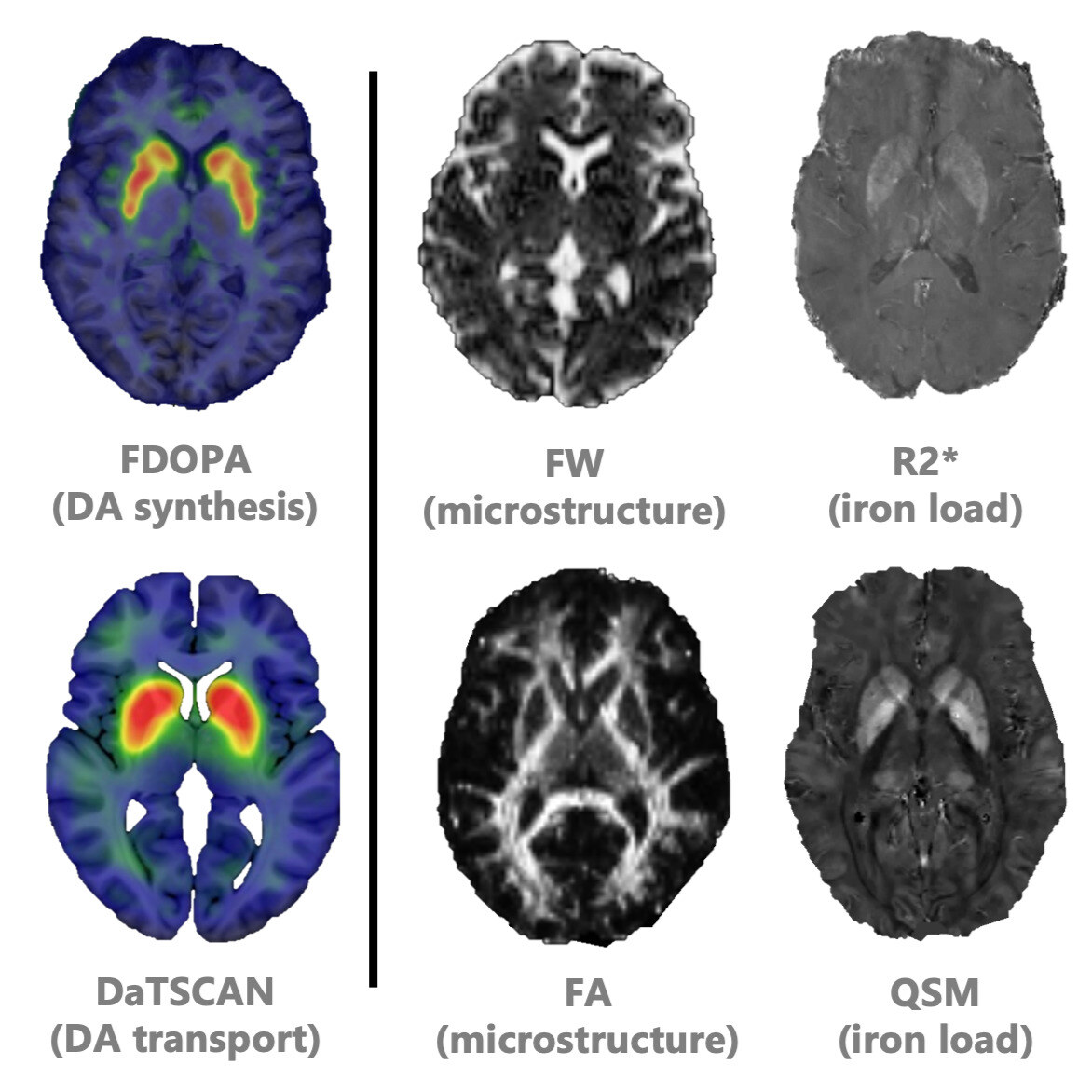 Neuroimaging figure